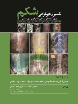 تفسیر رادیوگرافی شکم